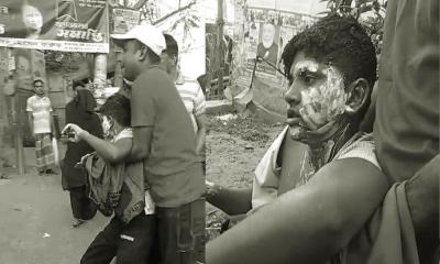 গাজীপুরে বিএনপির মিছিলে গ্যাস বেলুন বিস্ফোরণ: দগ্ধ ১৭